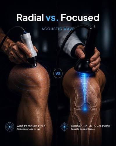 A split comparison graphic labeled 'Radial vs. Focused Acoustic Wave' showing two close-up views of a person's knee with handheld ultrasound devices applied.